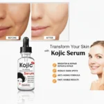 Roushun Kojic Skin Lightening Serum Anti-Dark Spots, Anti-Wrinkle & Hydrating Face Serum 4 Kojic-Serum.webp